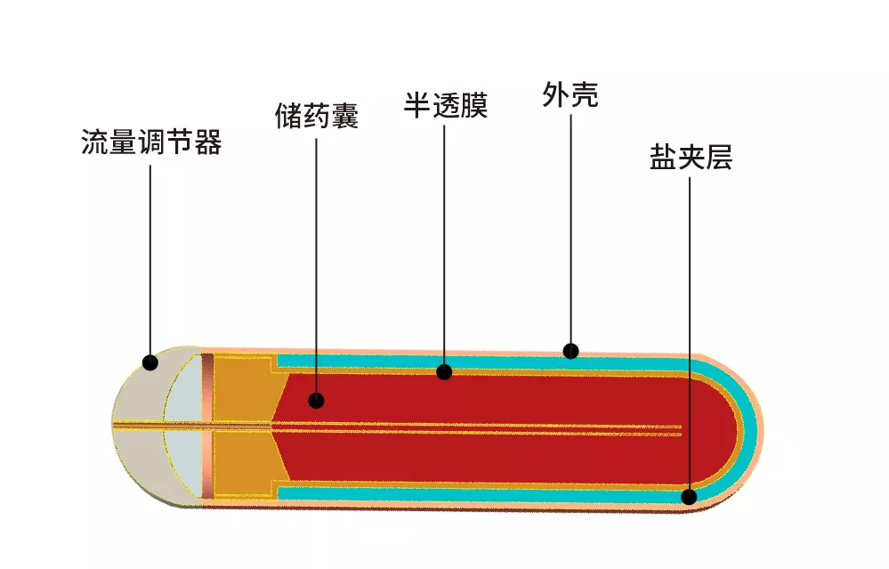 植入式缓释泵.png